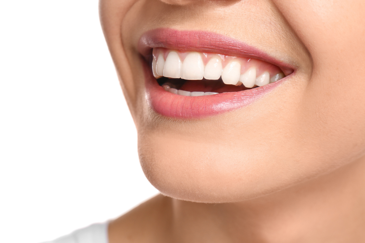 Teeth Whitening Can Improve Your Smile