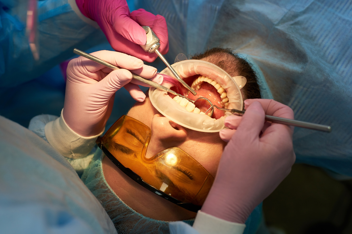 oral surgery for smile